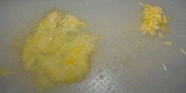 постные котлеты из капусты