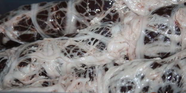 печень в жировой сетке